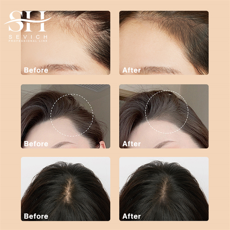 SEVICH 12g Hairline Powder Wit – Rooting Hormone Powder Bewertung und Preis